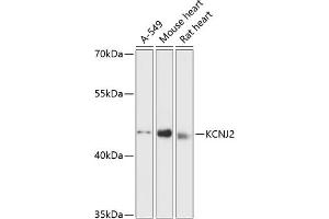 Western blot analysis of extracts of various cell lines, using KCNJ2 antibody (ABIN6129431, ABIN6142727, ABIN6142729 and ABIN6216772) at 1:3000 dilution.