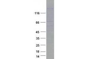 Validation with Western Blot