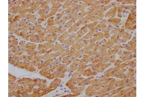 IHC image of ABIN7180354 diluted at 1:100 and staining in paraffin-embedded human heart tissue performed on a Leica BondTM system. (beta Actin anticorps)