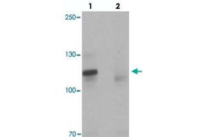 Western blot analysis of TSHZ3 in mouse brain tissue with TSHZ3 polyclonal antibody  at 1 ug/mL in (lane 1) the absence and (lane 2) the presence of blocking peptide. (TSHZ3 anticorps  (N-Term))