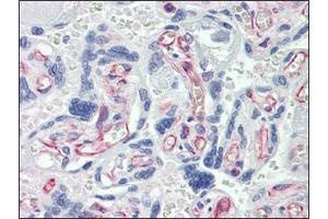 Immunohistochemistry (IHC) image for anti-Caspase 7, Apoptosis-Related Cysteine Peptidase (CASP7) antibody (ABIN614356) (Caspase 7 anticorps)