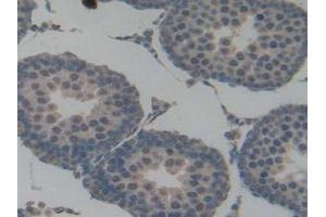 Detection of PAI1 in Rat Testis Tissue using Polyclonal Antibody to Plasminogen Activator Inhibitor 1 (PAI1)