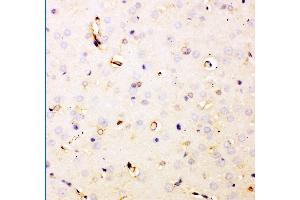 Anti- DHFR Picoband antibody,IHC(P) IHC(P): Rat Brain Tissue (Dihydrofolate Reductase anticorps  (AA 2-187))