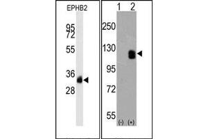 Western Blotting (WB) image for anti-EPH Receptor B2 (EPHB2) antibody (ABIN356401) (EPH Receptor B2 anticorps)