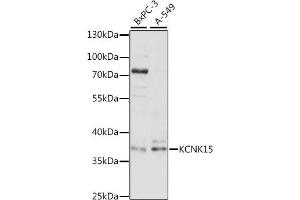 Western blot analysis of extracts of various cell lines, using KCNK15 antibody (ABIN7269466) at 1:1000 dilution. (KCNK15 anticorps  (AA 200-300))