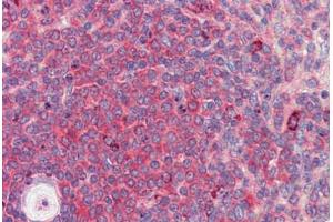 Human Spleen (formalin-fixed, paraffin-embedded) stained with BACH2 antibody ABIN462219 followed by biotinylated goat anti-rabbit IgG secondary antibody ABIN481713, alkaline phosphatase-streptavidin and chromogen.