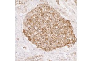 Immunohistochemistry (IHC) image for anti-Annexin A1 (ANXA1) (AA 25-75) antibody (ABIN7453914)