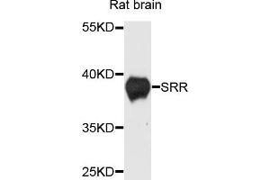 Western blot analysis of extracts of rat brain cells, using SRR antibody. (SRR anticorps)