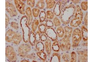 IHC image of ABIN7127638 diluted at 1:100 and staining in paraffin-embedded human kidney tissue performed on a Leica BondTM system.