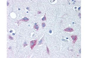 Anti-WNT8B antibody IHC of human brain, cortex. (WNT8B anticorps  (Internal Region))