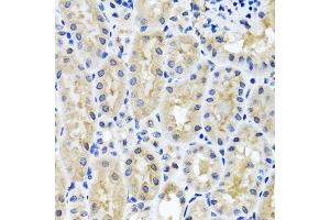 Immunohistochemistry of paraffin-embedded mouse kidney using SNAP29 antibody.