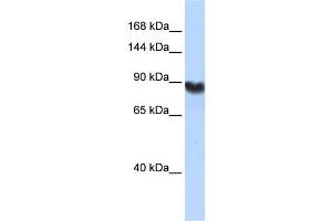 WB Suggested Anti-LIG1 Antibody Titration: 0. (LIG1 anticorps  (Middle Region))