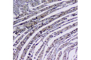IHC analysis of Integrin alpha 5 using anti-Integrin alpha 5 antibody . (ITGA5 anticorps  (AA 42-263))