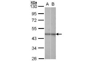 WB Image Sample (30 ug of whole cell lysate) A: Hela B: Raji 10% SDS PAGE antibody diluted at 1:1000 (NR2F6 anticorps  (C-Term))