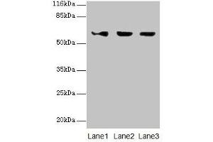 Western blot All lanes: ATL3 antibody at 2 μg/mL Lane 1: Jurkat whole cell lysate Lane 2: Hela whole cell lysate Lane 3: HepG2 whole cell lysate Secondary Goat polyclonal to rabbit IgG at 1/10000 dilution Predicted band size: 61 kDa Observed band size: 61 kDa (ATL3 anticorps  (AA 1-187))
