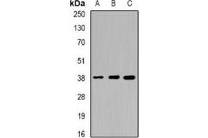 Western blot analysis of Sorbitol Dehydrogenase expression in HT29 (A), mouse liver (B), mouse kidney (C) whole cell lysates. (SORD anticorps)