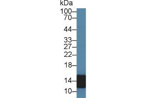 Detection of S100A8 in Human Leukocyte lysate using Polyclonal Antibody to S100 Calcium Binding Protein A8 (S100A8) (S100A8 anticorps  (AA 1-89))