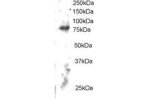 Western Blotting (WB) image for anti-Engulfment and Cell Motility 2 (ELMO2) (C-Term) antibody (ABIN2465647) (ELMO2 anticorps  (C-Term))