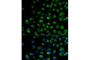 Immunofluorescence analysis of U2OS cells using IFNAR2 Polyclonal Antibody