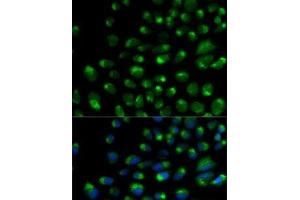 Immunofluorescence analysis of U2OS cells using IFNAR2 Polyclonal Antibody (IFNAR2 anticorps)