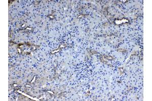 IHC analysis of CD151 using anti- CD151 antibody . (CD151 anticorps  (AA 113-175))