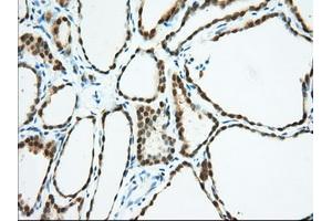 Immunohistochemical staining of paraffin-embedded Human pancreas tissue using anti-BDH2 mouse monoclonal antibody. (BDH2 anticorps)