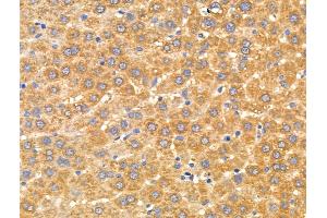 ABIN6256912 and ABIN6274865 at 1/100 staining Rat liver tissue by IHC-P. (Arylsulfatase A anticorps  (Internal Region))