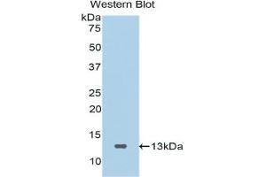 Western blot analysis of the recombinant protein. (SFRP4 anticorps  (AA 265-346))