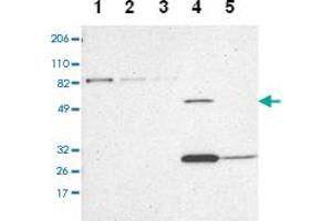 Western blot analysis of Lane 1: RT-4, Lane 2: U-251 MG, Lane 3: A-431, Lane 4: Liver, Lane 5: Tonsil with ZNF75A polyclonal antibody at 1:100-1:250 dilution. (ZNF75A anticorps)
