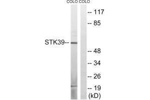 Western blot analysis of extracts from COLO cells, using STK39 (Ab-311) antibody.
