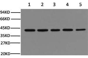 Western Blotting (WB) image for anti-Actin, beta (ACTB) antibody (ABIN5958070) (beta Actin anticorps)