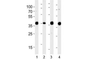 Western blot analysis of lysate from 1) 293, 2) RD, 3) mouse NIH3T3 and 4) rat L6 cell line using Aldolase antibody at 1:1000.