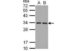 WB Image Sample (30 ug of whole cell lysate) A: A431 B: HeLa 12% SDS PAGE antibody diluted at 1:5000 (HIV-1 Tat Interactive Protein 2, 30kDa (HTATIP2) anticorps)