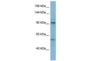 ATP2A1 antibody used at 1 ug/ml to detect target protein.