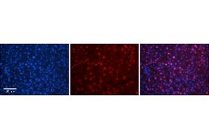 Rabbit Anti-TBX10 Antibody      Formalin Fixed Paraffin Embedded Tissue: Human Adult Liver   Observed Staining: Nuclear in hepatocytes, strong signal, wide tissue distribution  Primary Antibody Concentration: 1:100  Secondary Antibody: Donkey anti-Rabbit-Cy3  Secondary Antibody Concentration: 1:200  Magnification: 20X  Exposure Time: 0.