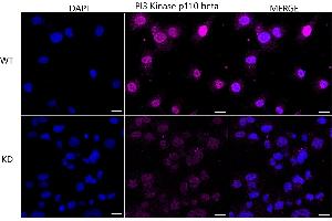 Immunocytochemical staining of HT- cells using PI3 Kinase p110 beta antibody (ABIN7799817), 1:1,000), Top panel: wild-type (WT), Bottom panal: PI3 Kinase p110 beta shRNA knockdown (KD). (Recombinant PIK3CB anticorps)