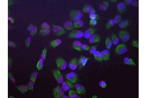 Immunofluorescence of HeLa cells showing strong granular nuclear staining of SAP49 in red and vimentin ( ABIN361371) in green.