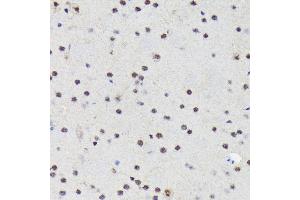 Immunohistochemistry of paraffin-embedded mouse brain using PRP19 Rabbit mAb (ABIN7269505) at dilution of 1:100 (40x lens). (PRP19 anticorps)