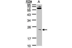 WB Image Sample(30 ug whole cell lysate) A:293T 12% SDS PAGE antibody diluted at 1:1000 (UBE2M anticorps)