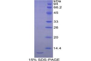 SDS-PAGE analysis of Human Selenoprotein W1 Protein. (Selenoprotein W Protéine)