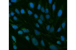 anti-Transmembrane Protein 88 (TMEM88) (C-Term) antibody