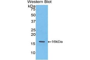 Western blot analysis of the recombinant protein. (TNNT3 anticorps  (AA 147-269))