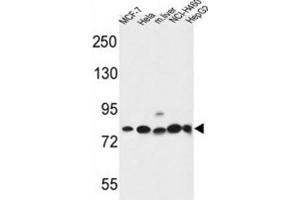 Western Blotting (WB) image for anti-Gephyrin (GPHN) antibody (ABIN3004319) (Gephyrin anticorps)