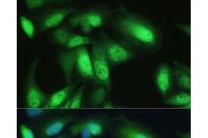 Immunofluorescence analysis of U-2 OS cells using VCP Polyclonal Antibody at dilution of 1:100. (VCP anticorps)