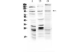 Western blot analysis of Semaphorin 3A using anti-Semaphorin 3A antibody . (SEMA3A anticorps  (AA 21-223))