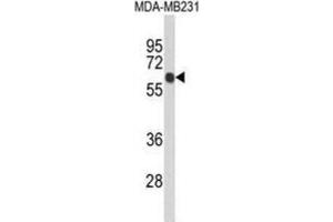 Western Blotting (WB) image for anti-Ankyrin Repeat Domain 13C (ANKRD13C) antibody (ABIN3004051) (ANKRD13C anticorps)