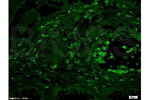 anti-Interleukin 4 Receptor (IL4R) (AA 201-300) antibody