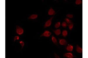 ABIN6267069 staining MCF7 by IF/ICC.