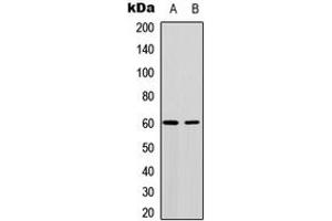 Western blot analysis of AKT expression in MCF7 (A), NIH3T3 (B) whole cell lysates. (AKT1 anticorps  (Center))