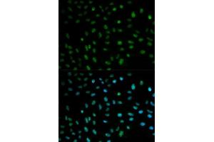 Immunofluorescence analysis of MCF-7 cells using ELAVL1 antibody.